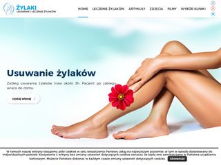 Podgląd leczeniezylakow.com