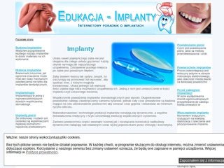 Podgląd implanty.edu.pl