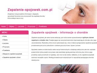 Miniaturka zapalenie-spojowek.com.pl