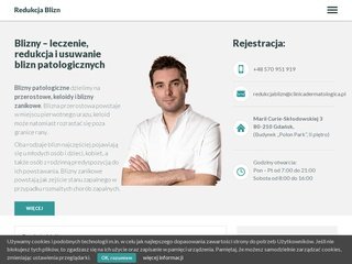 Podgląd redukcjablizn.pl