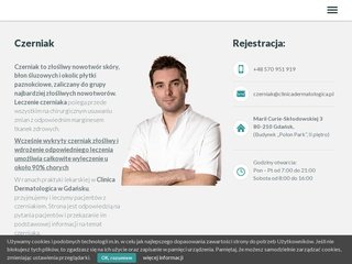 Podgląd wykryjczerniaka.pl