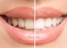 Dlaczego regularne wizyty u dentysty w Szczecinie to najlepsza inwestycja w zdrowie?